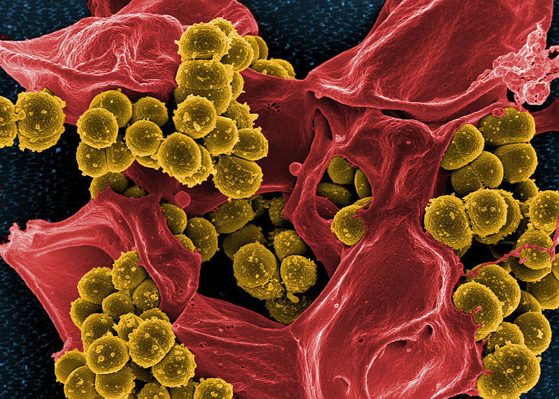Teixobactin: Το νέο αντιβιοτικό με δράση και στα ανθεκτικά βακτήρια