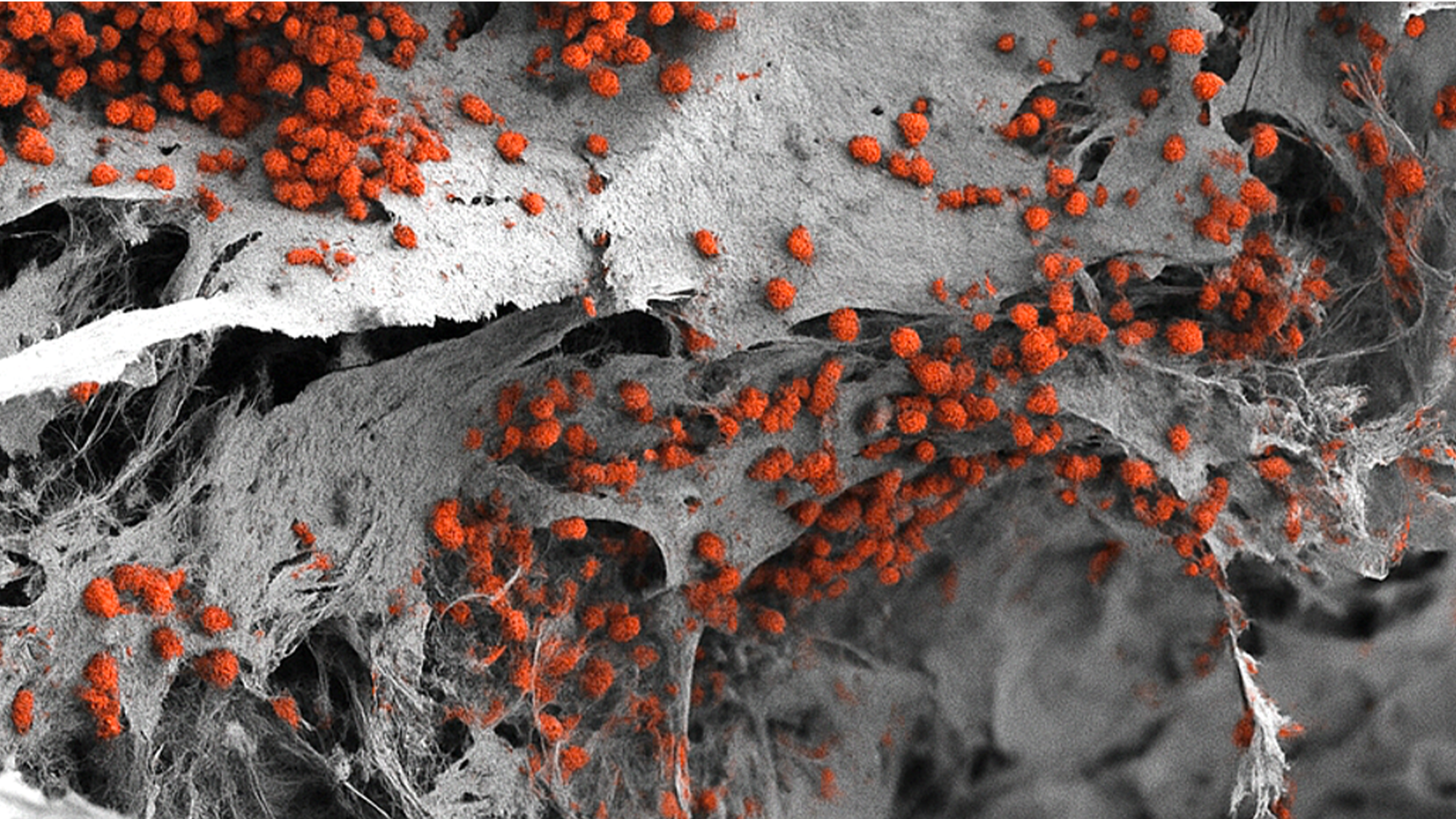 Μυελός των Οστών φτιαγμένος εξ ολοκλήρου στο εργαστήριο