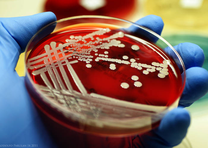 Malacidns: Η νέα γενιά αντιβιοτικών κατά των ανθεκτικών βακτηρίων